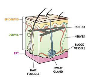 Skin diagram showing where tattoo pigment and hair follicles exist